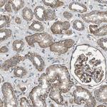 ERC1 Antibody in Immunohistochemistry (IHC)