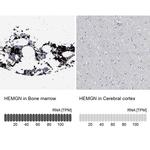 HEMGN Antibody in Immunohistochemistry (IHC)