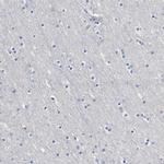 HEMGN Antibody in Immunohistochemistry (IHC)