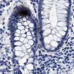 HEMGN Antibody in Immunohistochemistry (IHC)