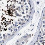 HEMGN Antibody in Immunohistochemistry (IHC)