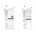 Annexin A13 Antibody in Western Blot (WB)