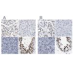 DBC1 Antibody in Immunohistochemistry (IHC)