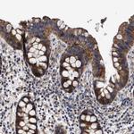 MALSU1 Antibody in Immunohistochemistry (IHC)