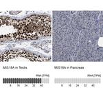 MIS18A Antibody in Immunohistochemistry (IHC)