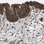 HAUS6 Antibody in Immunohistochemistry (IHC)