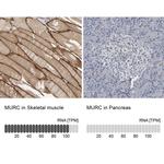 MURC Antibody in Immunohistochemistry (IHC)