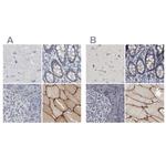 MURC Antibody in Immunohistochemistry (IHC)