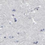 MURC Antibody in Immunohistochemistry (IHC)