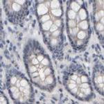 MURC Antibody in Immunohistochemistry (IHC)