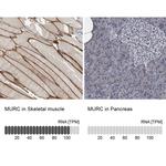 MURC Antibody in Immunohistochemistry (IHC)