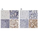 MURC Antibody in Immunohistochemistry (IHC)