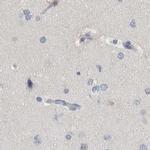 MURC Antibody in Immunohistochemistry (IHC)