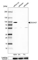 ZCCHC7 Antibody