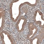 ZCCHC7 Antibody in Immunohistochemistry (IHC)