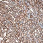 ZCCHC7 Antibody in Immunohistochemistry (IHC)