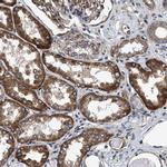 MRPS30 Antibody in Immunohistochemistry (IHC)