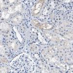 KIFC3 Antibody in Immunohistochemistry (IHC)