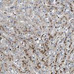 DPP2 Antibody in Immunohistochemistry (IHC)