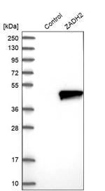 ZADH2 Antibody in Western Blot (WB)