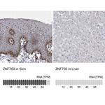 ZNF750 Antibody in Immunohistochemistry (IHC)