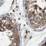 CCDC44 Antibody in Immunohistochemistry (IHC)