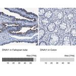 DNAI1 Antibody in Immunohistochemistry (IHC)