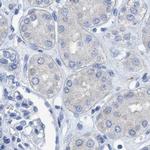 DNAI1 Antibody in Immunohistochemistry (IHC)