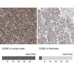 CCM2 Antibody in Immunohistochemistry (IHC)