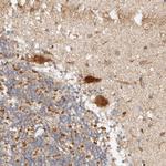 KIF9 Antibody in Immunohistochemistry (Paraffin) (IHC (P))