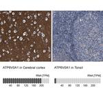 ATP6V0A1 Antibody in Immunohistochemistry (IHC)
