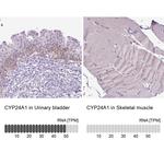 CYP24A1 Antibody