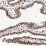 WRAP53 Antibody in Immunohistochemistry (IHC)