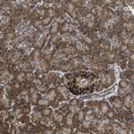 SLC38A10 Antibody in Immunohistochemistry (IHC)