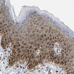 SLC38A10 Antibody in Immunohistochemistry (IHC)