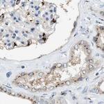 SLC38A10 Antibody in Immunohistochemistry (IHC)