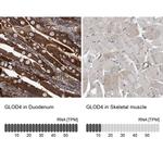 C17orf25 Antibody in Immunohistochemistry (IHC)