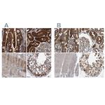 C17orf25 Antibody in Immunohistochemistry (IHC)