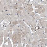 C17orf25 Antibody in Immunohistochemistry (IHC)