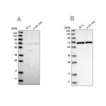 NPLOC4 Antibody in Western Blot (WB)