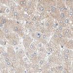 PCM1 Antibody in Immunohistochemistry (IHC)