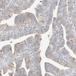 PCM1 Antibody in Immunohistochemistry (IHC)