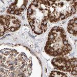 MRPL45 Antibody in Immunohistochemistry (IHC)