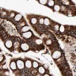 MRPL45 Antibody in Immunohistochemistry (IHC)