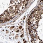 MRPL45 Antibody in Immunohistochemistry (IHC)