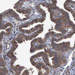 V-ATPase H Antibody in Immunohistochemistry (IHC)