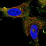 CEP55 Antibody in Immunocytochemistry (ICC/IF)