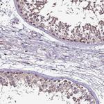 CEP55 Antibody in Immunohistochemistry (IHC)