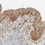 NXN Antibody in Immunohistochemistry (IHC)