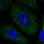 NCDN Antibody in Immunocytochemistry (ICC/IF)